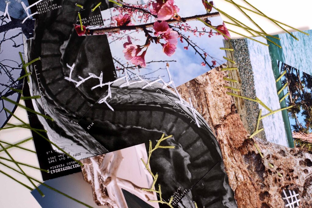 Exposição “Irradiações de corpo ausente”, de Guadalupe Fernandez Presas, ressignifica imagens a partir de fotos, documentos e radiografias. (Foto de: Divulgação)